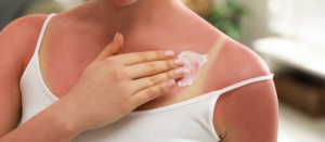A volta do calor: os riscos da exposição excessiva ao sol
